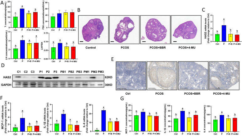 Graphical Abstract ベルベリンはヒアルロン酸合成酵素2の発現を阻害することにより多嚢胞性卵巣症候群の炎症を緩和する