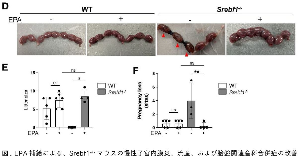 Graphical Abstract EPAの補充は脂質代謝の正常化に作用し慢性子宮内膜炎における炎症を改善する可能性